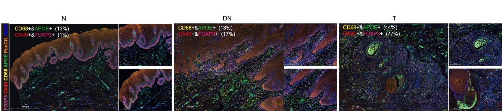 Open access visualization of Microscopy, mIHC Staining, APOE, CD68, FOXP3