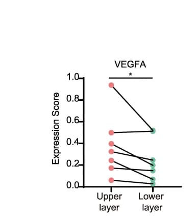 Open access visualization of Line Plot, Scatter Plot, Quantitative Scores, VEGFA, ST Sections