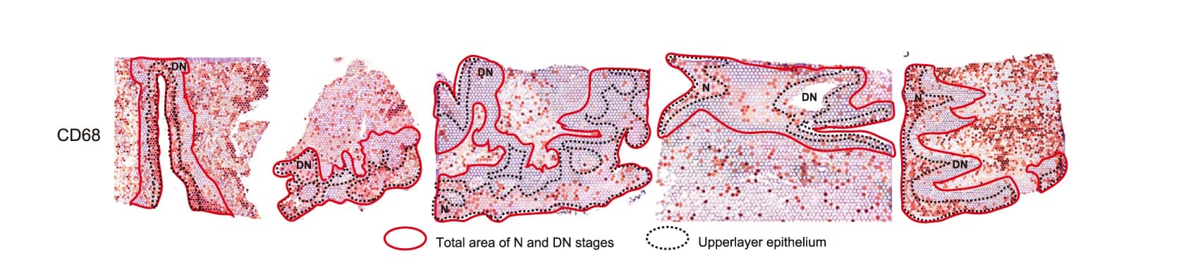 Open access visualization of Microscopy, ST Feature Plots, CD68, Epithelium, Keratinocytes