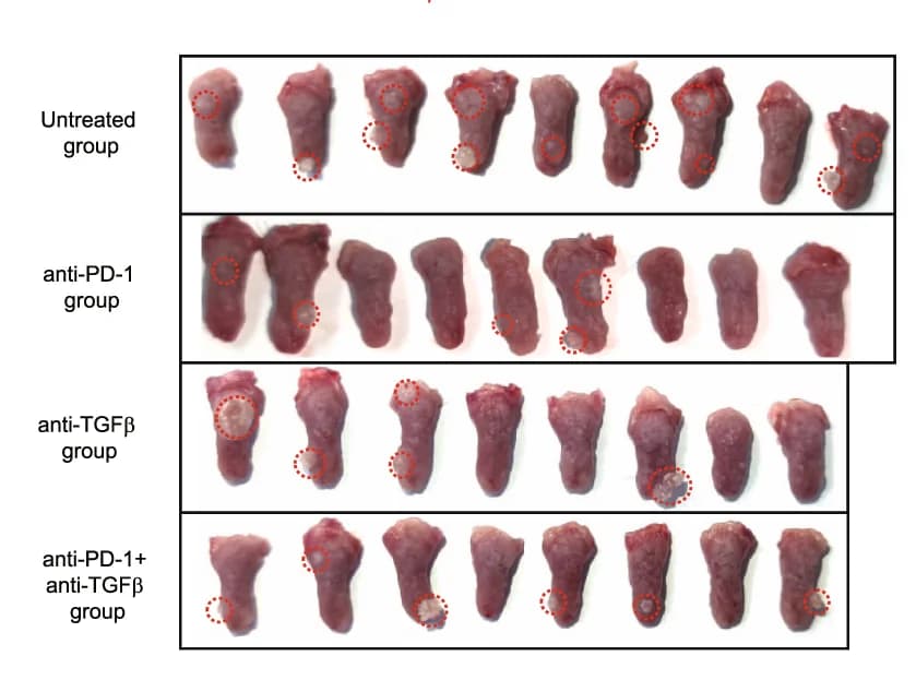 Open access visualization of Photo, Macroscopic lesions, Tongue, Cauliflower-like lesions