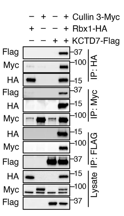 Open access visualization of Gel, Co-IP, Flag-tagged KCTD7, Myc-tagged Cullin-3, HA-tagged Rbx1