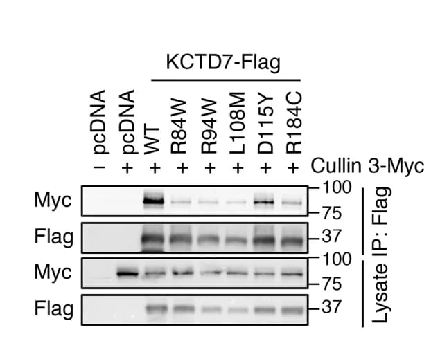 Open access visualization of Gel, Co-IP, GFP-tagged KCTD7, Flag-tagged Calpain 1, Flag-tagged Calpain 2