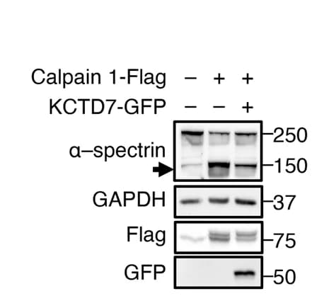 Open access visualization of Gel, Calpain 1, KCTD7, HEK293 Cells, α-spectrin Cleavage