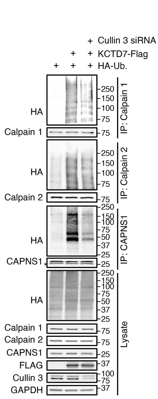 Open access visualization of Gel, In vivo ubiquitination assay, Calpain 1, Calpain 2, CAPNS1