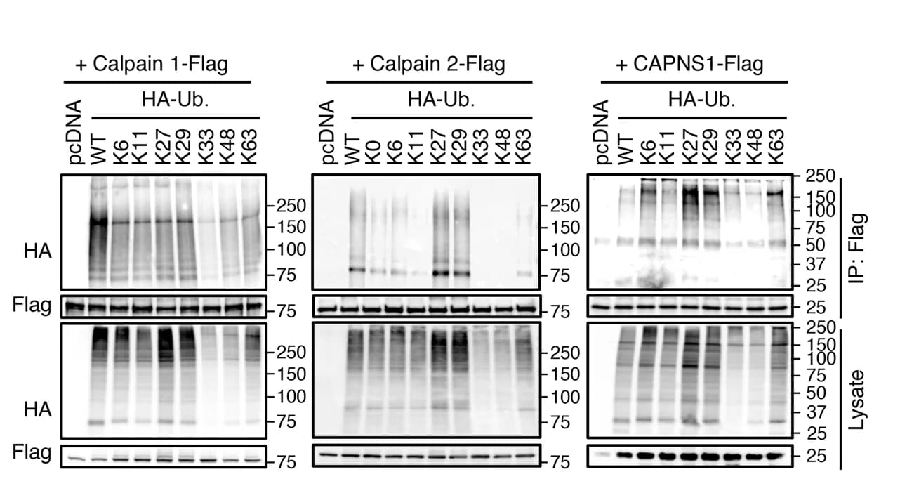 Open access visualization of Gel, In vivo ubiquitination assay, HEK293 Cells, Calpain 1, Calpain 2