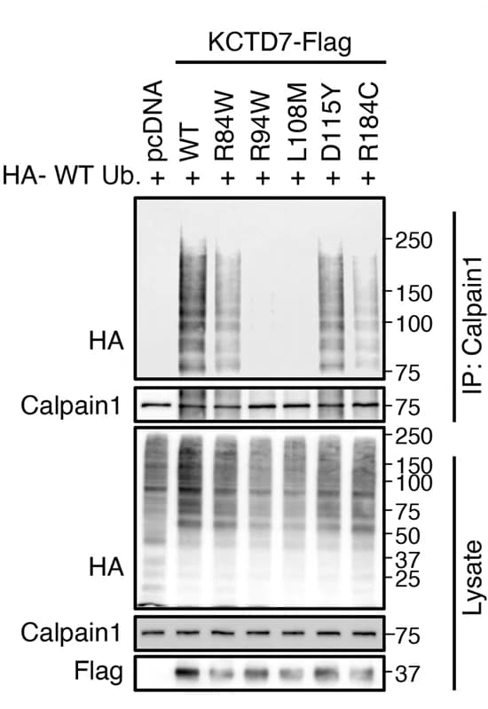 Open access visualization of Gel, In Vivo, Ubiquitination Assay, Calpain1, KCTD7
