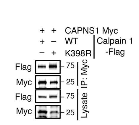 Open access visualization of Gel, Co-IP Analysis, CAPNS1, Calpain 1, K398R
