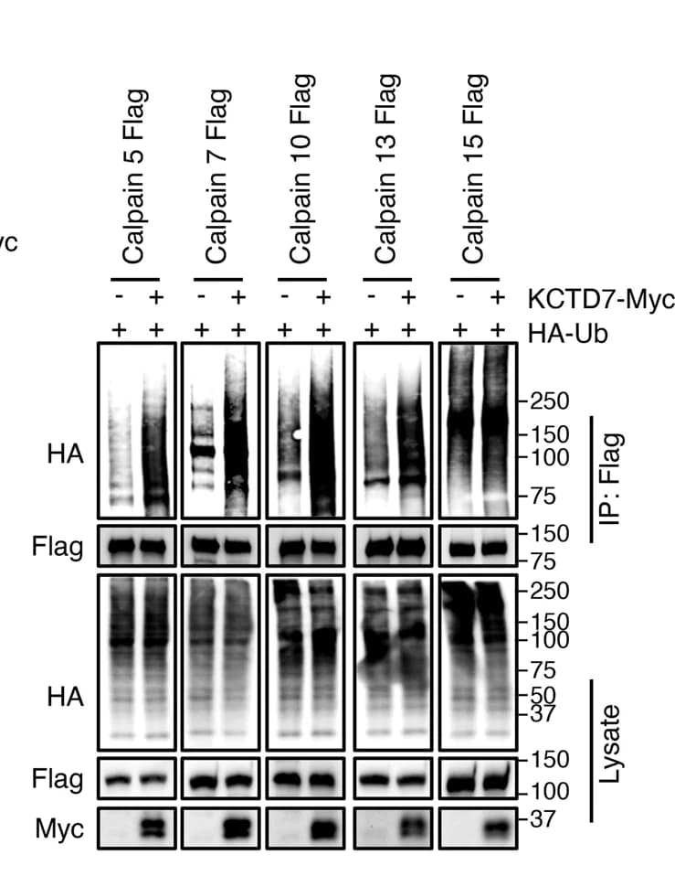 Open access visualization of Gel, In Vivo Ubiquitination Assay, HEK293 Cells, Calpains, KCTD7