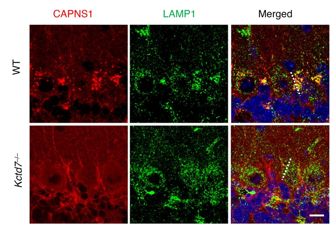 Open access visualization of Microscopy, Confocal Microscopy, Cerebellar Tissue, WT Mice, Kctd7 Mice