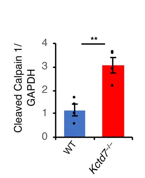 Open access visualization of Bar Plot, Error Bars, Cerebellar Tissue, WT Mice, Kctd7 Mice