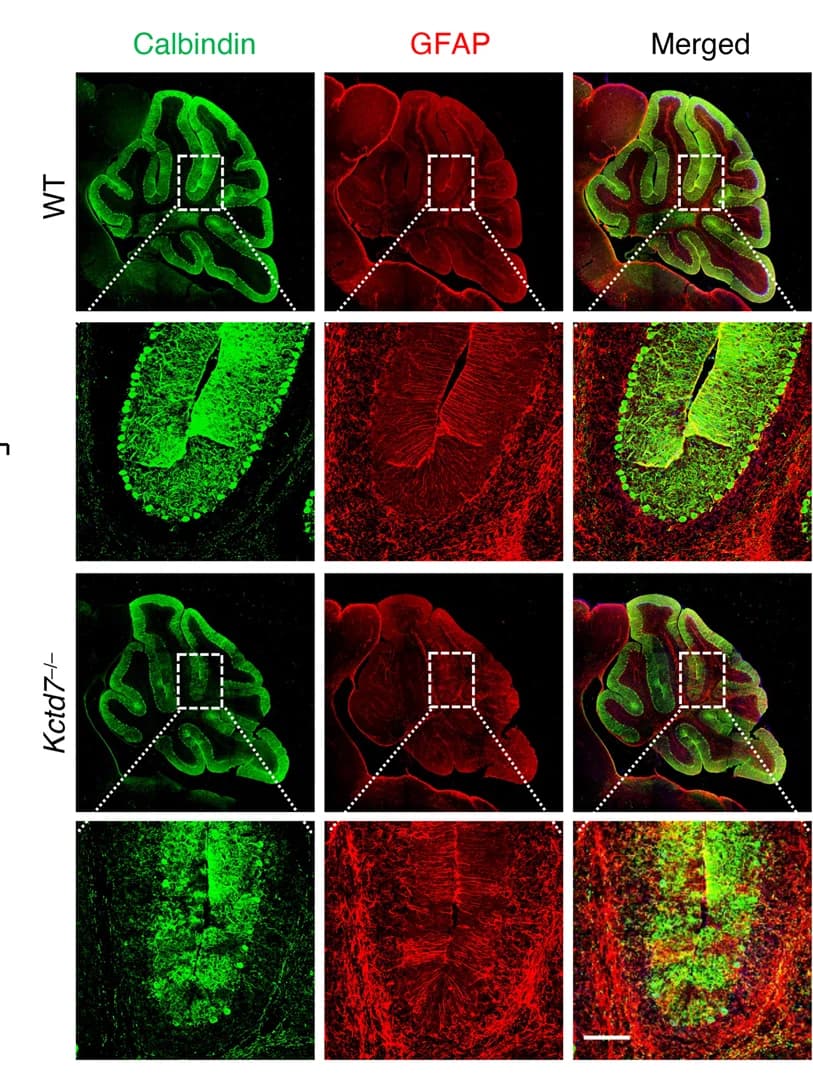 Open access visualization of Microscopy, Confocal Microscopy, Cerebellum, Astrocytes, Antibody