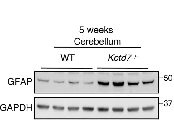 Open access visualization of Gel, Immunoblot Analysis, Cerebellar Tissue, Antibody