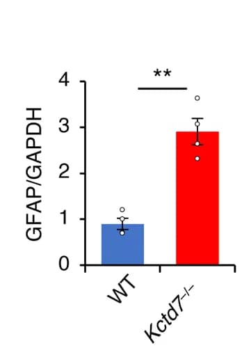 Open access visualization of Bar Plot, Error Bars, Immunoblot Analysis, Cerebellar Tissue, Antibody