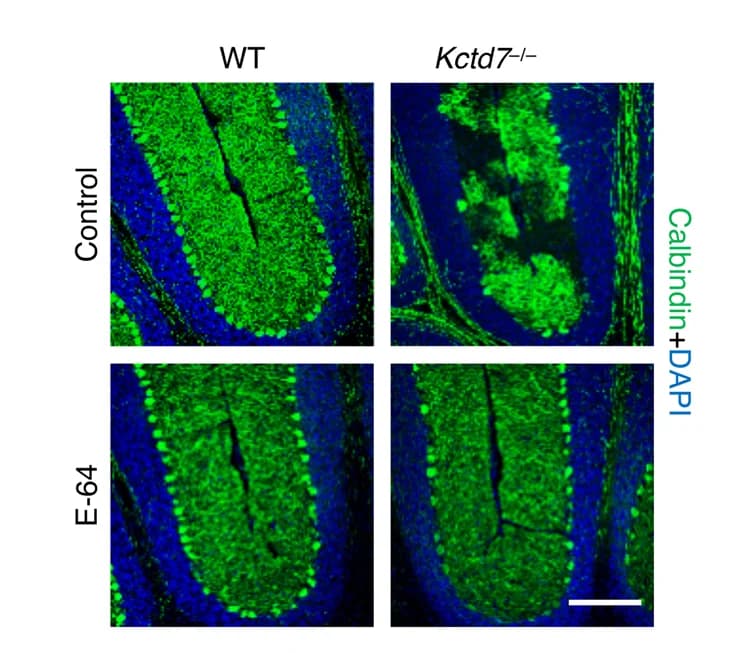 Open access visualization of Microscopy, Confocal Microscopy, Cerebellum, WT Mice, Kctd7 Mice