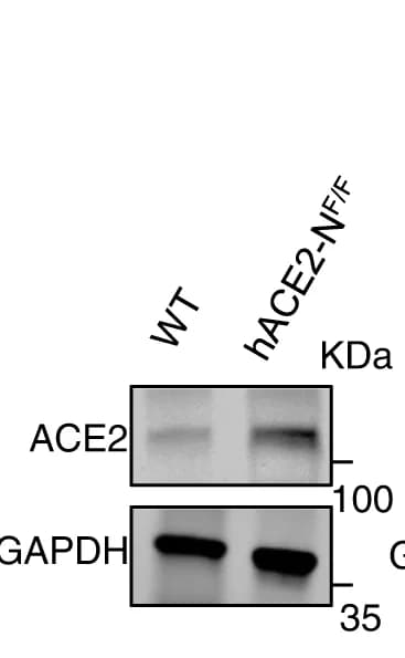 Open access visualization of Gel, Mouse Lung Tissue, SDS PAGE, Western Blot, ACE2 Antibody