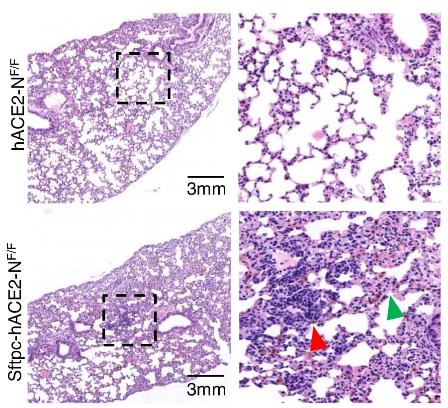 Open access visualization of Microscopy, Pathological Changes, Sftpc-hACE2-N F/F Mouse Lung, Inflammatory Infiltration, Fibroplasia