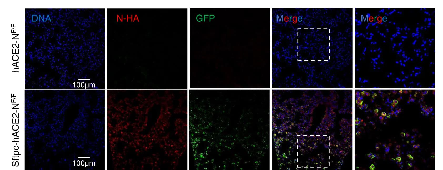 Open access visualization of Microscopy, Immunofluorescence Analysis, Mouse Lung Paraffin Sections, SARS-CoV-2 GFP/N GFP Protein, N-HA
