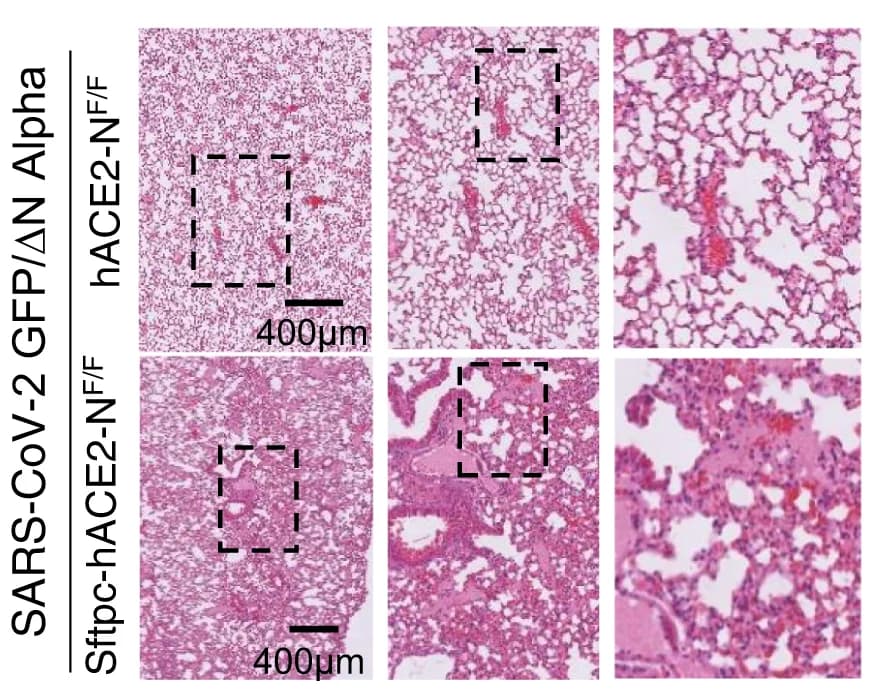 Open access visualization of Microscopy, H&E Staining, Mouse Lung, SARS-CoV-2, Alpha Variant