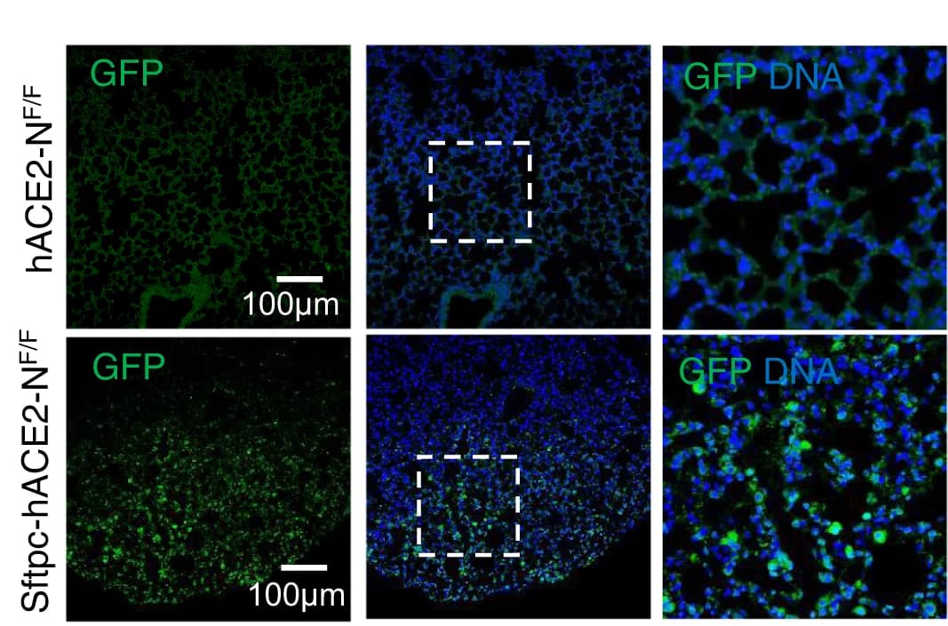 Open access visualization of Microscopy, Immunofluorescence Staining, Mouse Lungs, SARS-CoV-2, GFP Protein