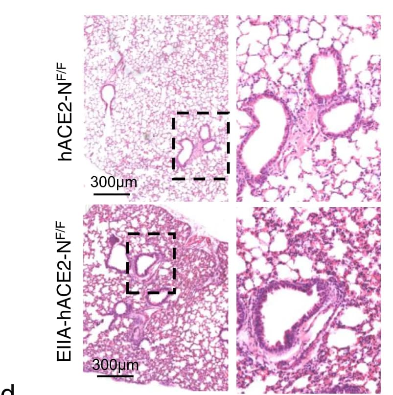 Open access visualization of Microscopy, Pathological Changes, Lungs, EIIA-hACE2-NF/F Mice, Infection