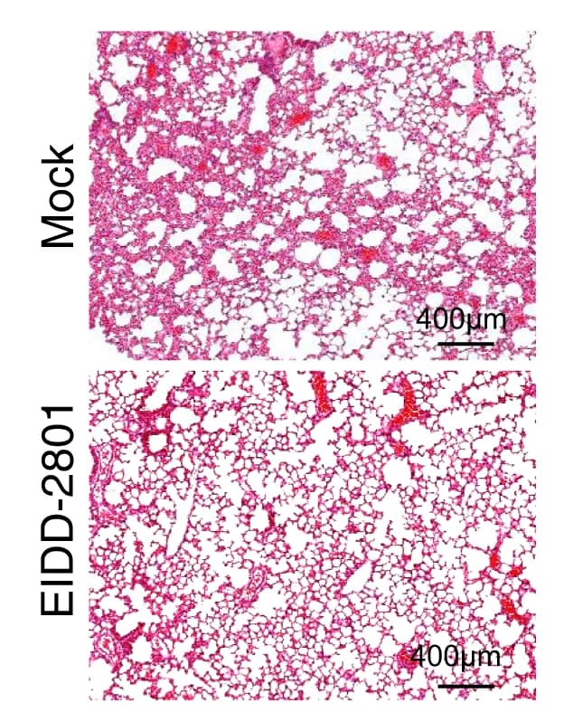 Open access visualization of Microscopy, H&E Staining, Lung Tissues, Vehicle, EIDD 2801