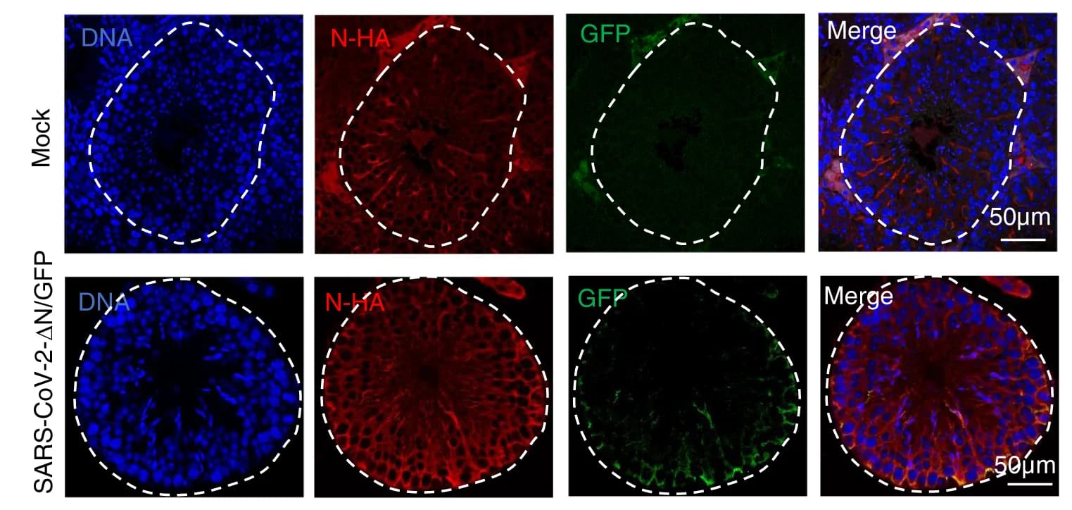 Open access visualization of Microscopy, Immunofluorescence Staining, SARS-CoV-2 GFP, AMH-hACE2-N F/F Mouse, Testes