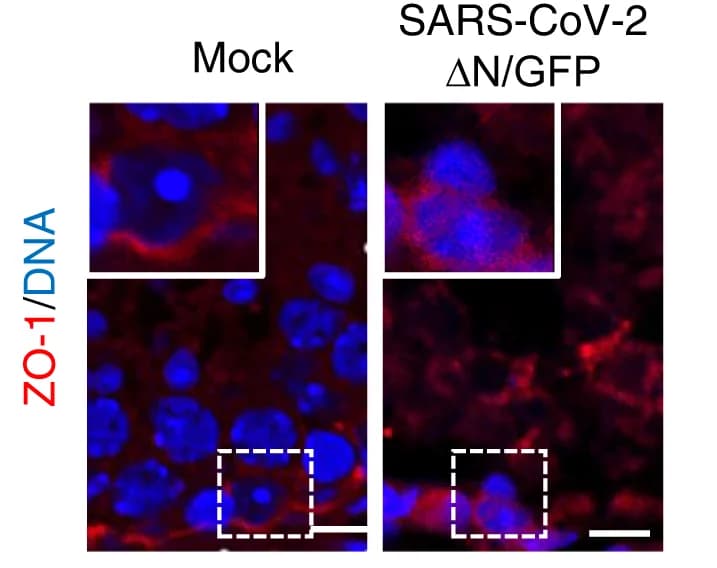 Open access visualization of Microscopy, Immunofluorescence, ZO-1, Mouse Testes, SARS-CoV-2