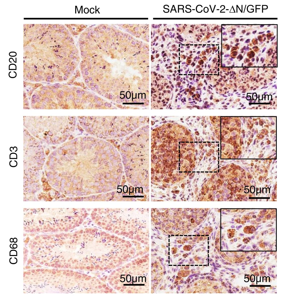 Open access visualization of Microscopy, IHC staining, B Cells, T Cells, Macrophages