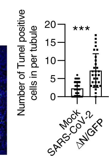Open access visualization of Box Plot, Scatter Plot, TUNEL-positive Cells, Seminiferous Tubule