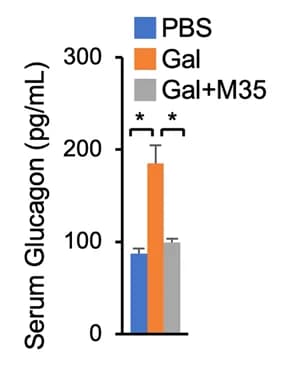 Open access visualization of Bar Plot, Error Bars, Clustered, Plasma Glucagon Levels, C57BL/6 Mice