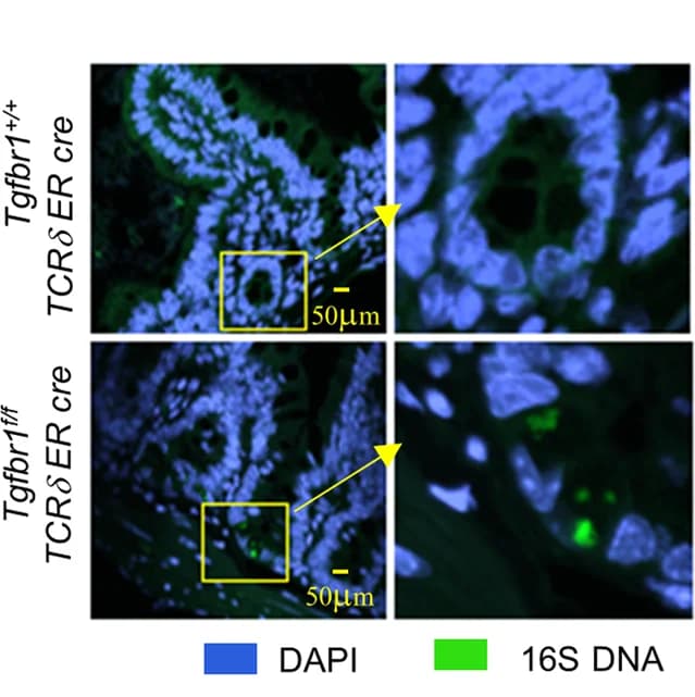 Open access visualization of Microscopy, FISH, Bacteria, Small Intestine, Tgfbr1 f/f TCRδ ER Cre Mice