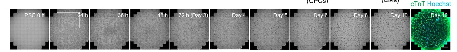 Open access visualization of Microscopy, Time-lapse Images, Bright-field Images, cTnT Fluorescence, Cardiac Differentiation