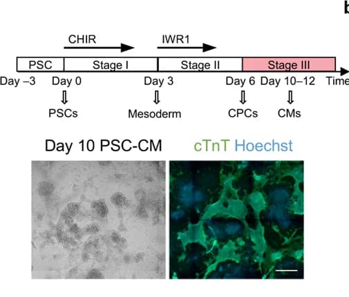 Open access visualization of Workflow, Microscopy, Bright-Field Images, cTnT Fluorescence, Cardiomyocytes