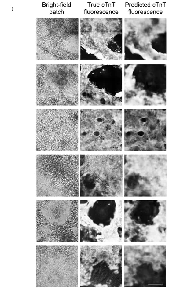 Open access visualization of Microscopy, Cardiomyocytes, Bright-Field Image Patches, cTnT Fluorescence, Image Prediction