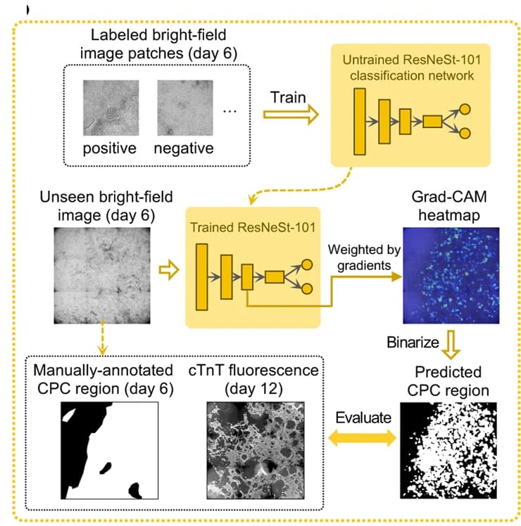 Open access visualization of Workflow, Microscopy, Heatmap, Weakly supervised learning, CPC recognition