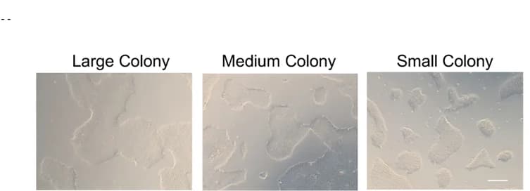 Open access visualization of Microscopy, Bright-Field Images, PSC Colonies, Colony Size, CHIR Treatment