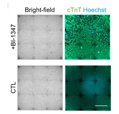 Open access visualization of Microscopy, BI-1347, Differentiation Efficiency, CHIR Dose, Bright-field Images