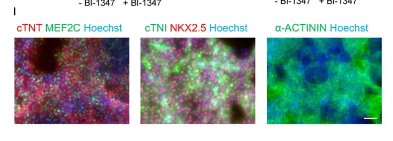 Open access visualization of Microscopy, Immunofluorescent Result, BI-1347, CHIR Dose, Fluorescent Images