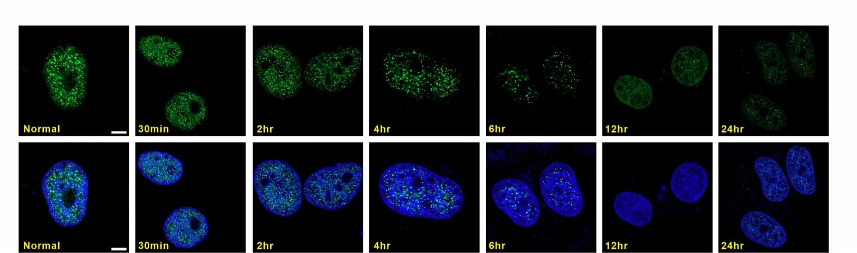 Open access visualization of Microscopy, Immunofluorescence, BRD4, Condensates, Time Points