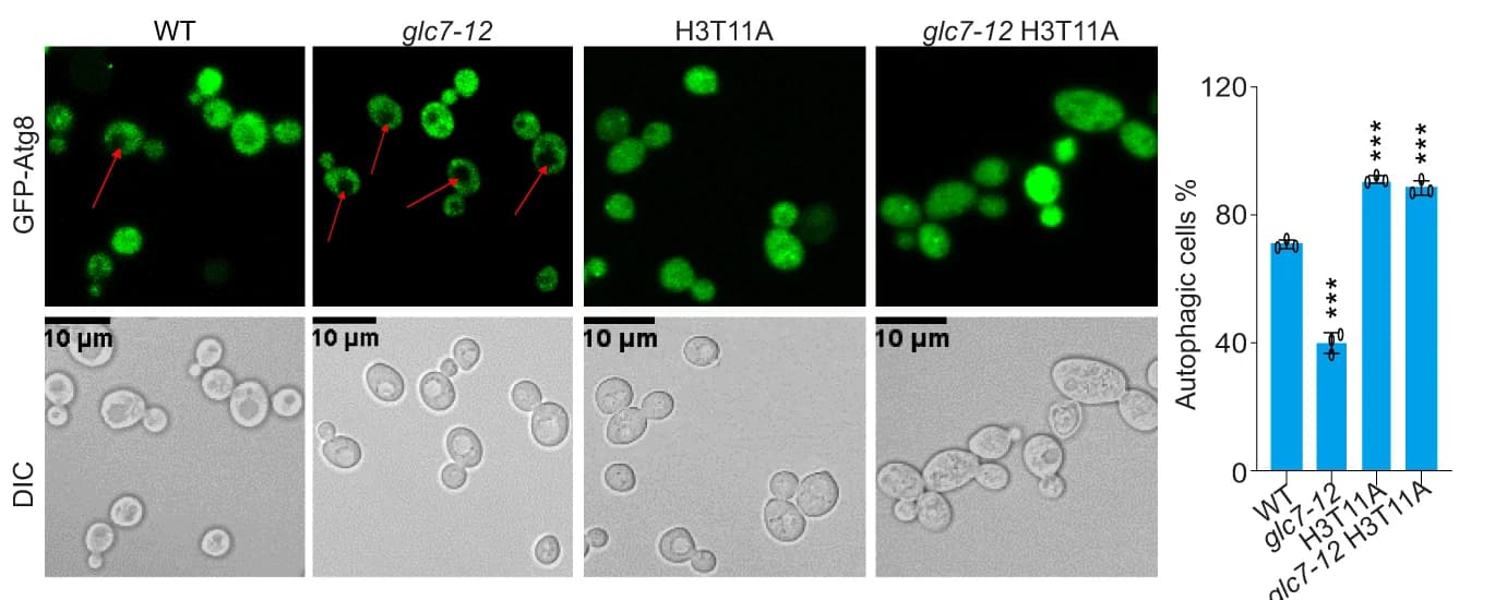Open access visualization of Bar Plot, Error Bars, Microscopy, Autophagy activity, WT