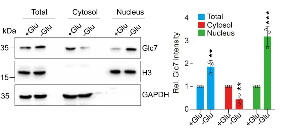 Open access visualization of Bar Plot, Error Bars, Gel, Subcellular Fractionation Assay, Glucose Starvation