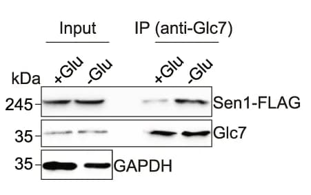 Open access visualization of Gel, Co-IP, Glc7, Sen1, SD-C (-Glu) Medium