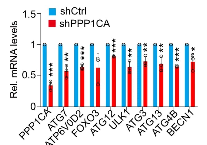 Open access visualization of Bar Plot, Error Bars, RT-qPCR, Transcription, Autophagy