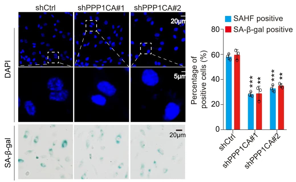 Open access visualization of Bar Plot, Microscopy, PPP1CA knockdown, Senescence, HUVECs