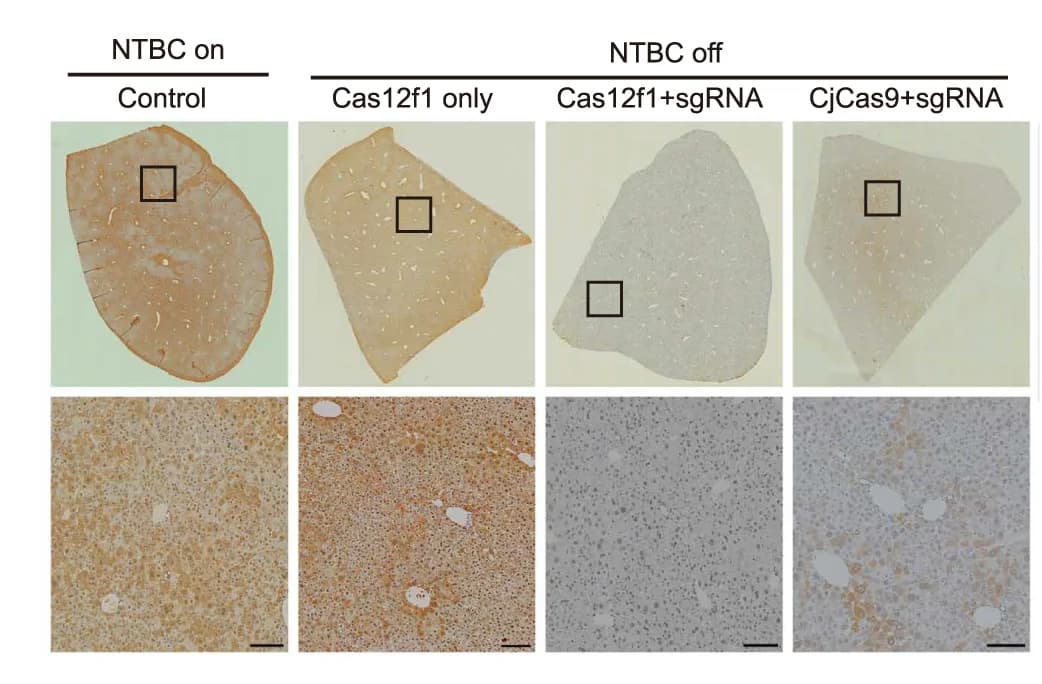 Open access visualization of Microscopy, Photo, HPD Staining, Liver, Tyrosinaemia Mice