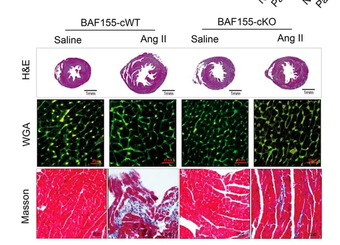 Open access visualization of Microscopy, H&E Staining, TRITC-labeled WGA Staining, Masson's Trichrome Staining, BAF155-cWT Hearts