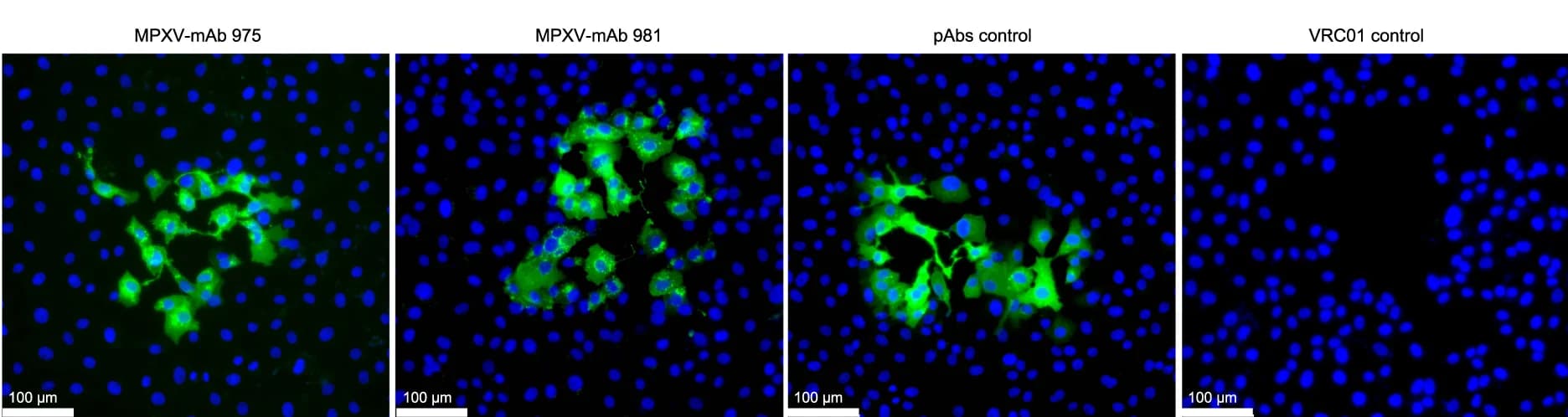 Open access visualization of Microscopy, Immunofluorescence, Vaccinia Virus, MPXV-mAb 975, MPXV-mAb 981