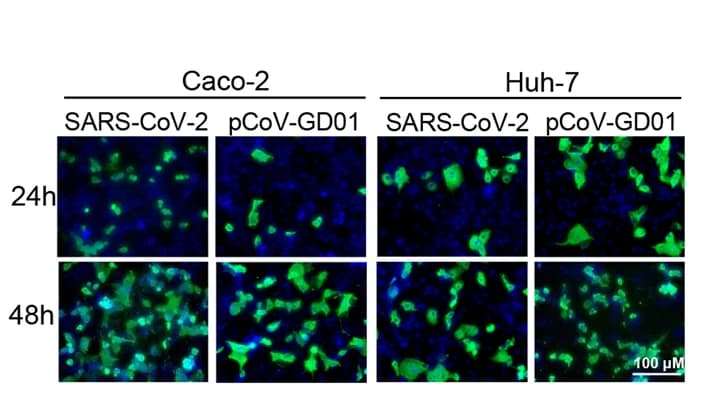 Open access visualization of Microscopy, IF Staining, Caco-2 Cells, Huh-7 Cells, SARS-CoV-2
