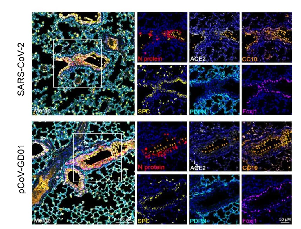 Open access visualization of Microscopy, Multiplex IF Staining, Inoculated Cells, Lungs, hACE2