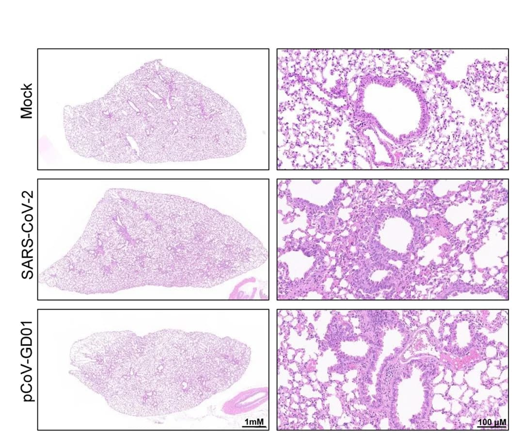 Open access visualization of Microscopy, Gross Necropsy, H&E Staining, Lung Tissue, pCoV-GD01